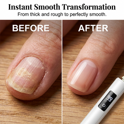 🥳2026 HOT SALE🥳💞50K+ SOLD!💅✨ 50% OFF! Nectavira® Professional Electric Nail Polisher – Smooths thick nails, 99-speed display. Multiple heads for shaping & buffing. Salon at home! 🌟💎